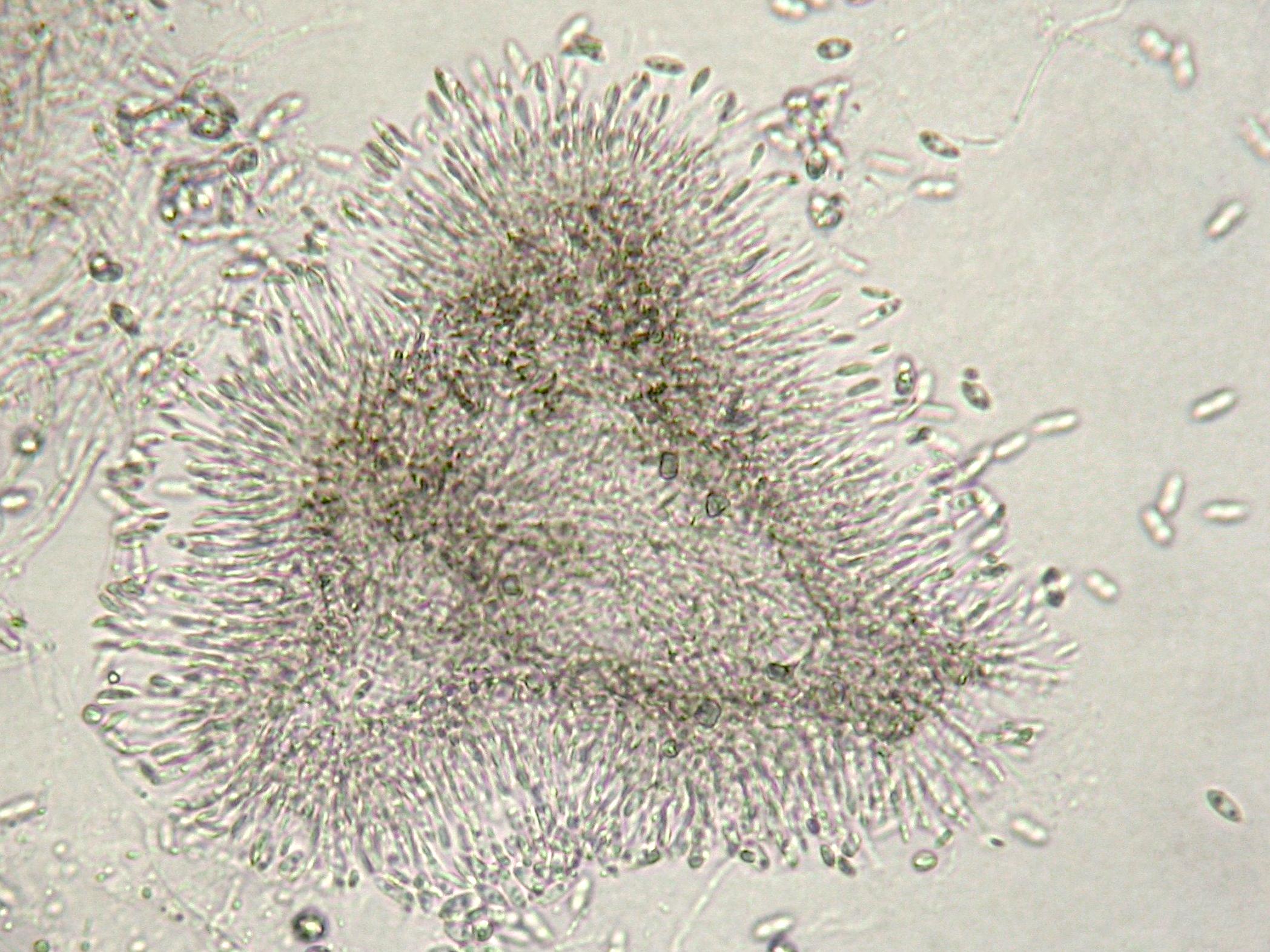 Phomopsis_sp_1