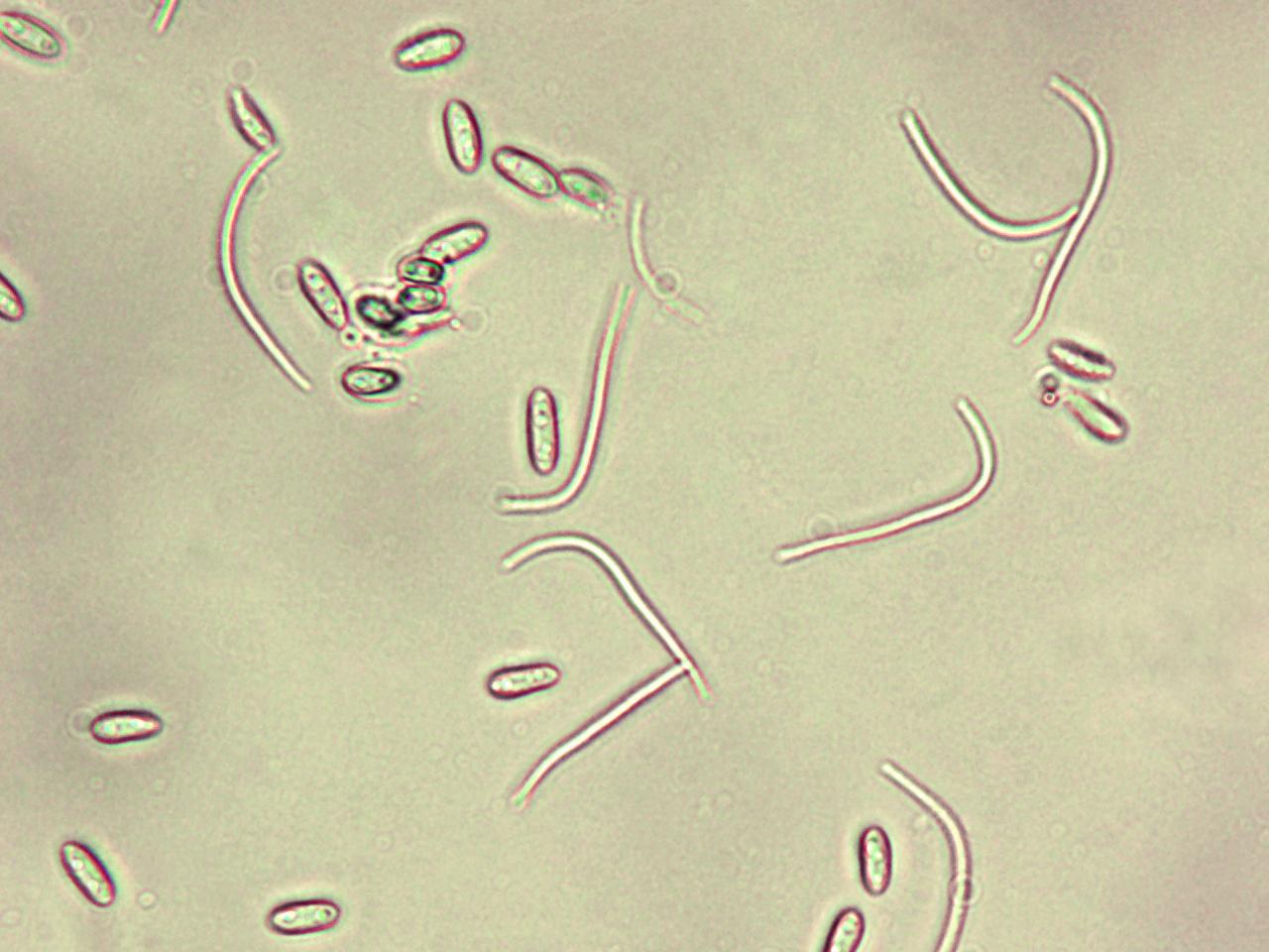 Phomopsis_sp_3