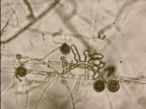 Pythium_aphanidermatum_1
