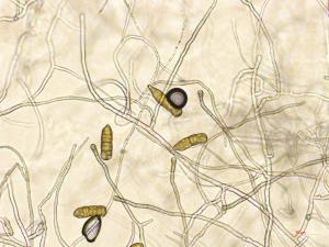 Stemphylium_sp_3