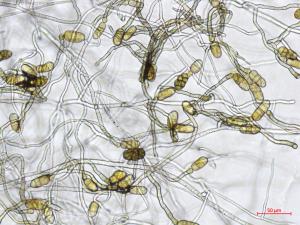 Stemphylium_sp_4