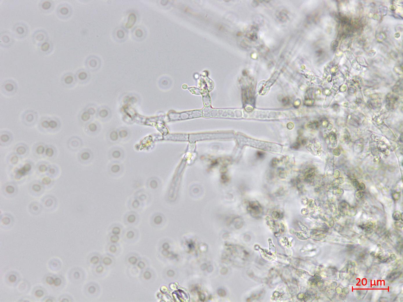 Trichoderma_virens_1