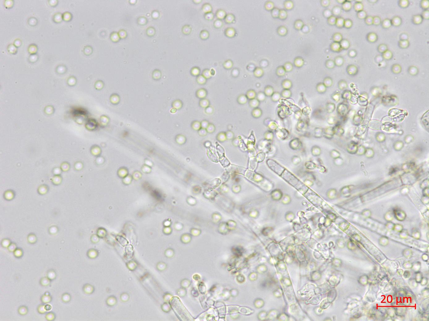 Trichoderma_virens_2