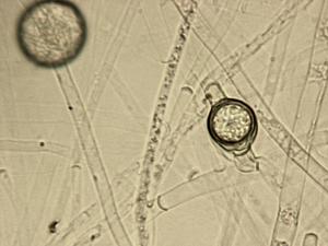 Pythium_ultimum_1