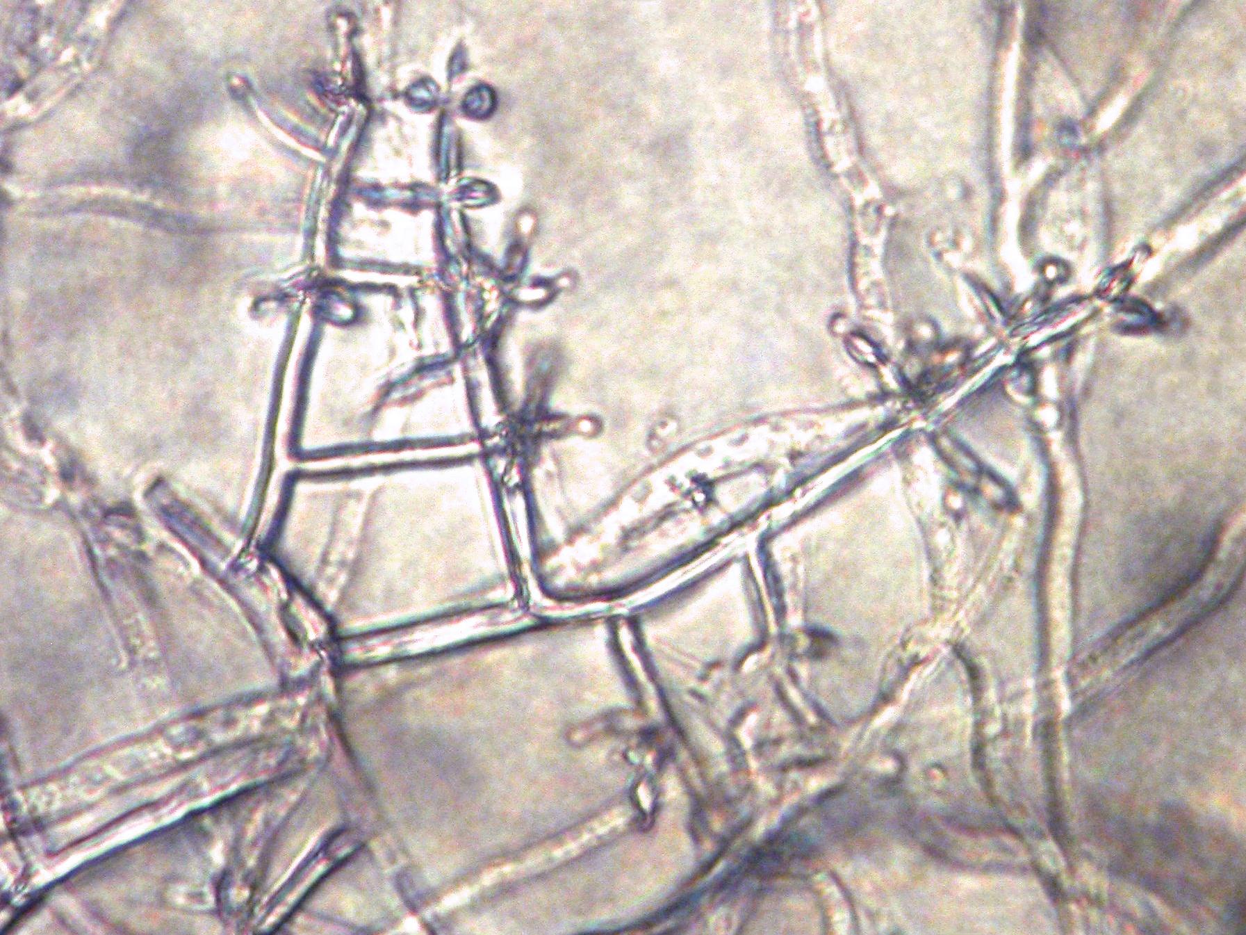 Trichoderma_sp_2