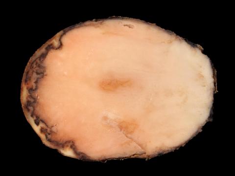 Pomme de terre - Pourriture rose (Phytophthora erythroseptica)