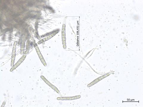 Phyllachora maydis