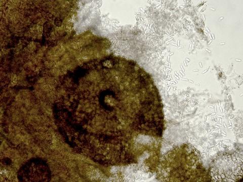 Ascochyta-01_LQ