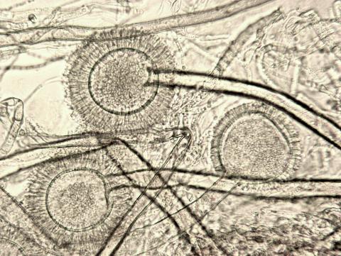 Aspergillus-32_LQ