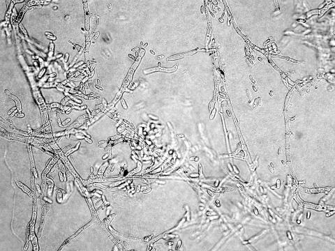 Aureobasidium-01_LQ