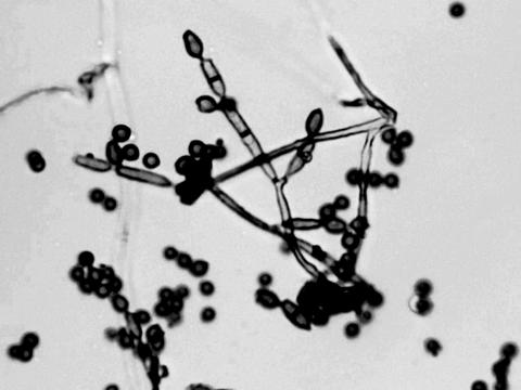Cladosporium-13