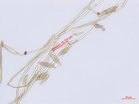 Cladosporium_D52838-1_LQ