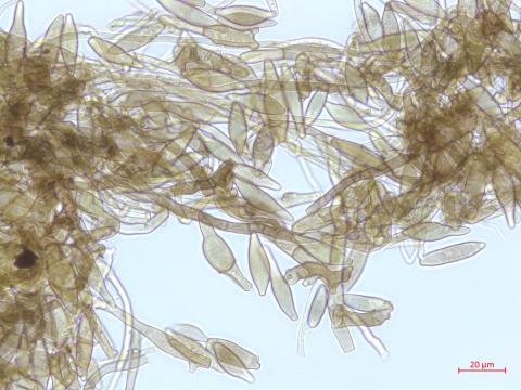 Cladosporium_D52838-2_LQ