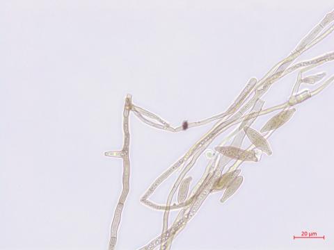 Cladosporium_D52838-3_LQ