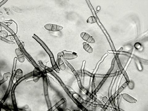 Cladosporium_brassicae-01