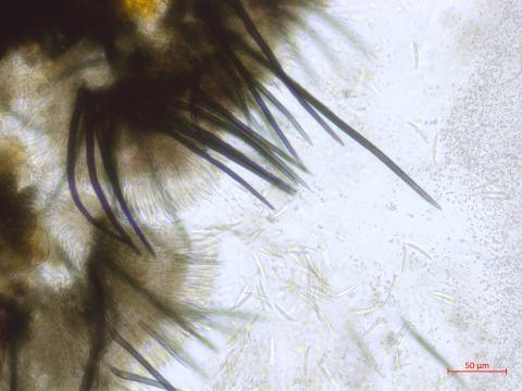 Colletotrichum_D52185_LQ