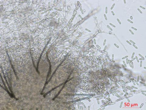 Colletotrichum_coccodes_D35079-2_LQ