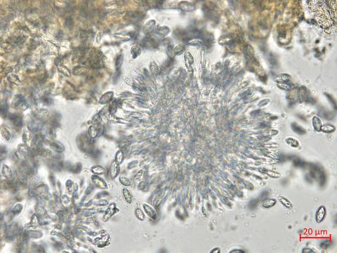 Coniella_diplodiella_D33070-1_LQ