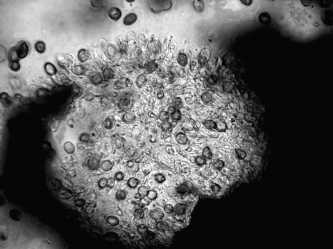 Coniothyrium-16_LQ