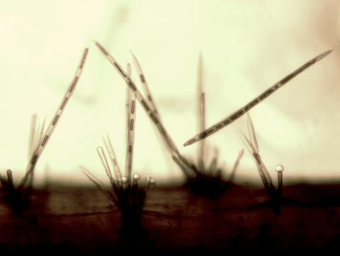 Corynespora-30_LQ