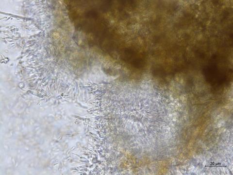 Cytospora_chrysosperma_D55858-1_LQ