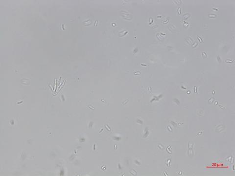 Cytospora_leucostoma_D44677-1_Conidies_LQ