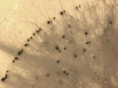 Pestalotiopsis_sp_4