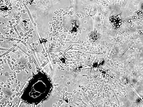 Geotrichum_sp_1