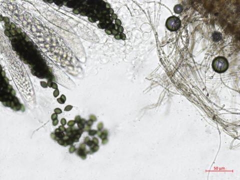 Podospora_sp_2