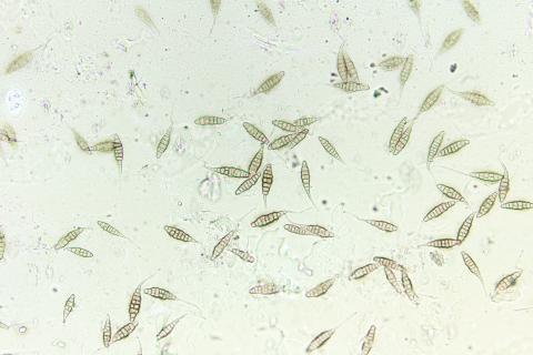 Alternaria sp.
